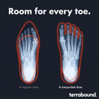 Illustration of toe position in a regular narrow shoe compared with a toe-pocket shoe